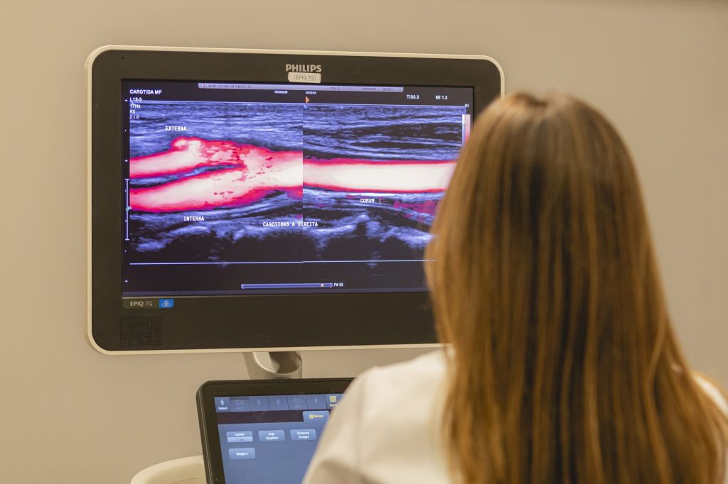 Monitor de ecodoppler exibindo fluxo sanguíneo